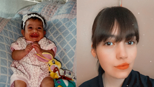 Anali as a baby and as an adult