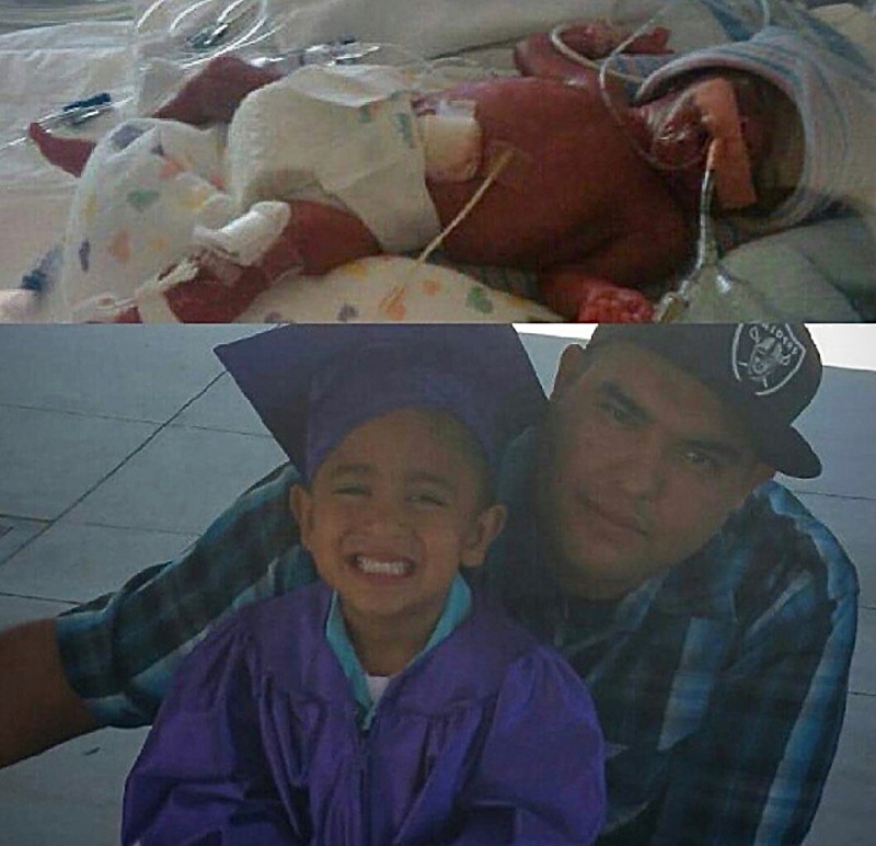 David in Valley Children's NICU and today