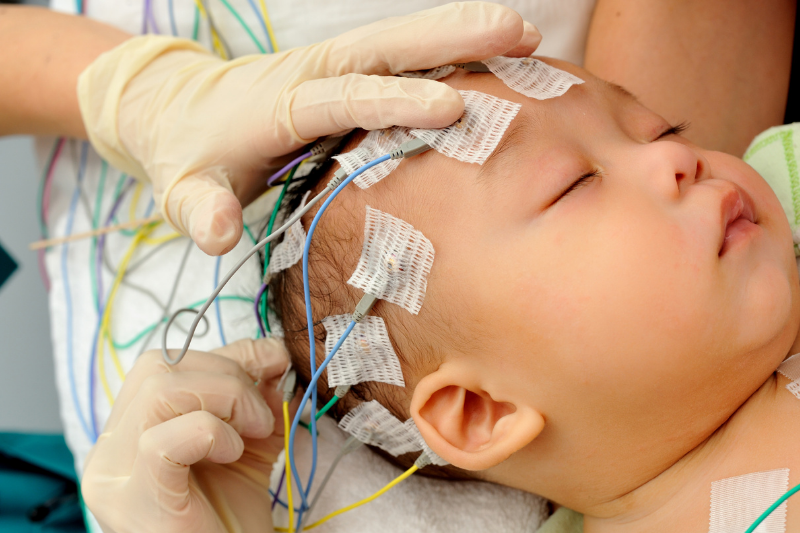 A baby lies in a hospital bed with wires attached to his head.